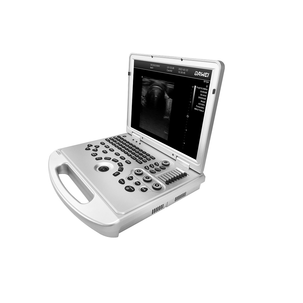 Ultrasound - ECO